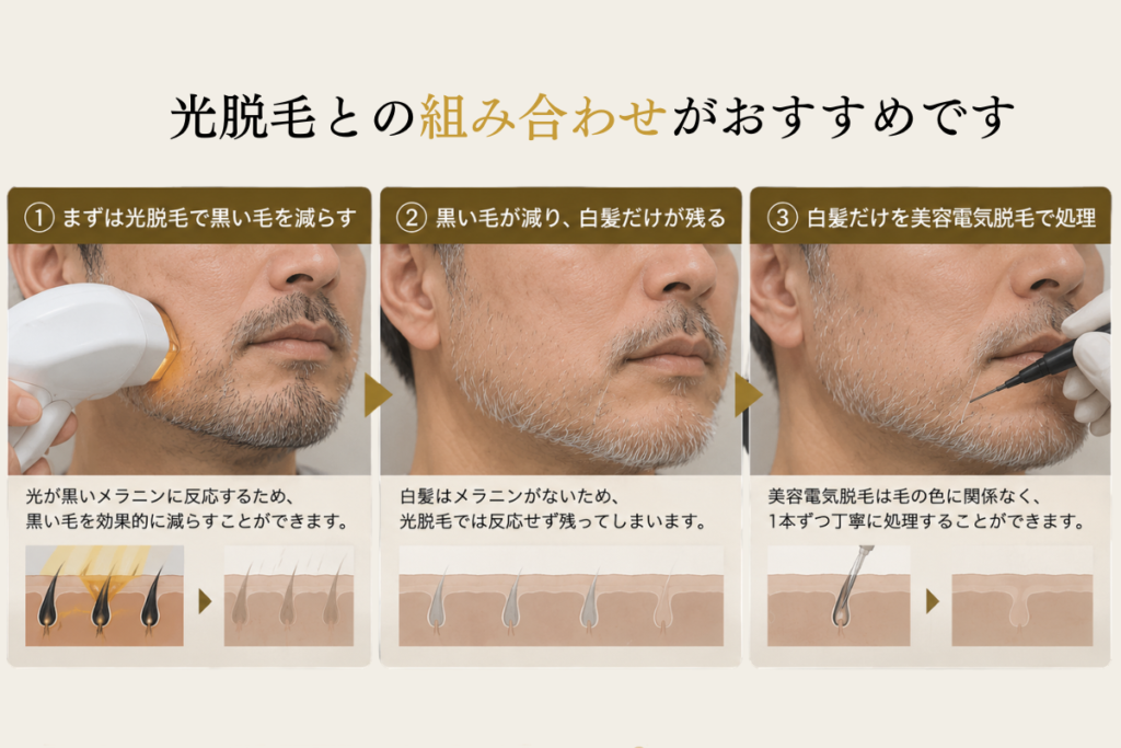 光脱毛との組み合わせ