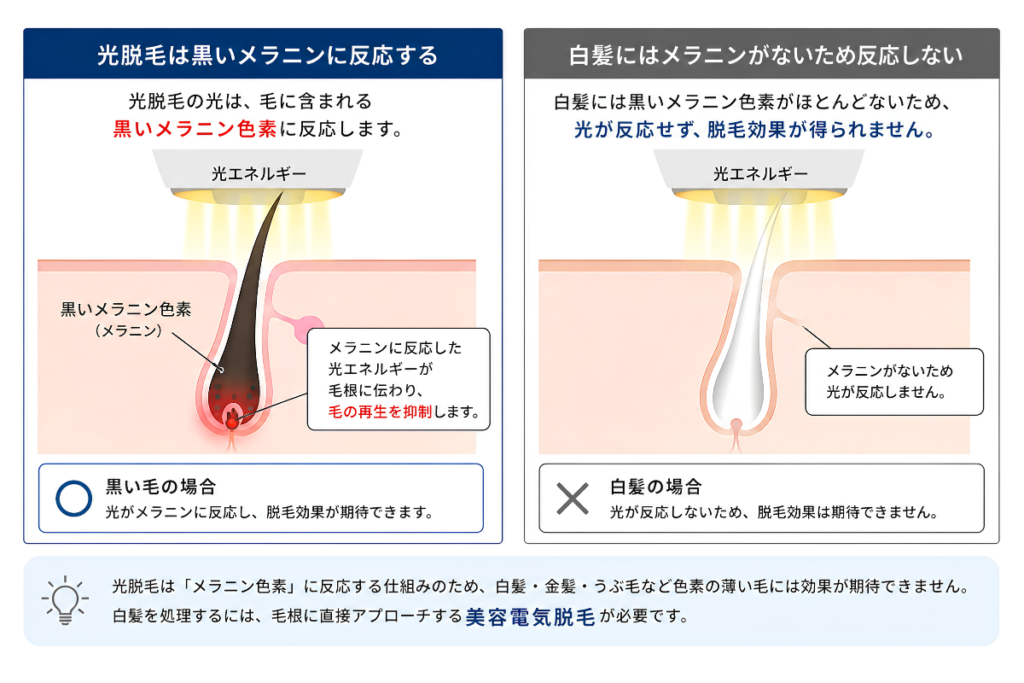 白髪は脱毛できない